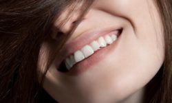 Натуральные способы отбеливания зубов