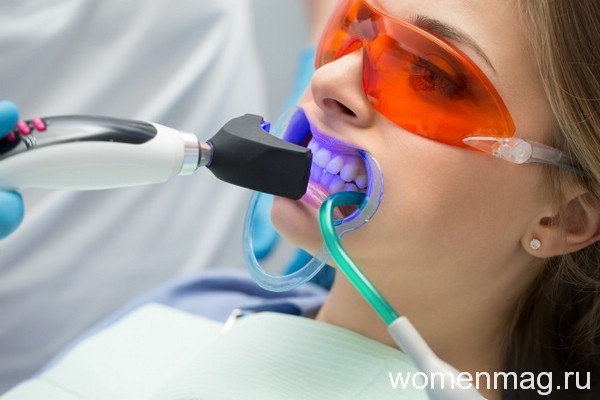 Домашнее отбеливание зубов с использованием стоматологических процедур